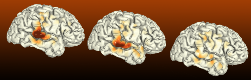 Image of activity on the brain while listening to speech sounds